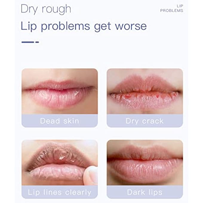 rayihni LIP SCRUBS, 10G MOISTURIZING HYDRATING CLEANSING LIP SCRUBS EXFOLIATOR, KERATIN DIMINISH LIP LINES DELICATE MILD LIP MOISTURIZER FOR WOMEN FOR LIP CARE - Image 4